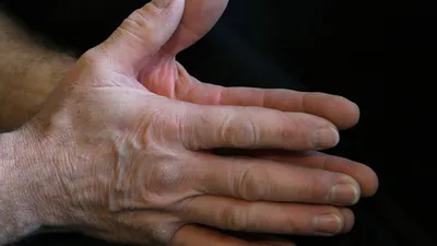 3 Kinds Of Health Foods Beneficial To Osteoarthrit