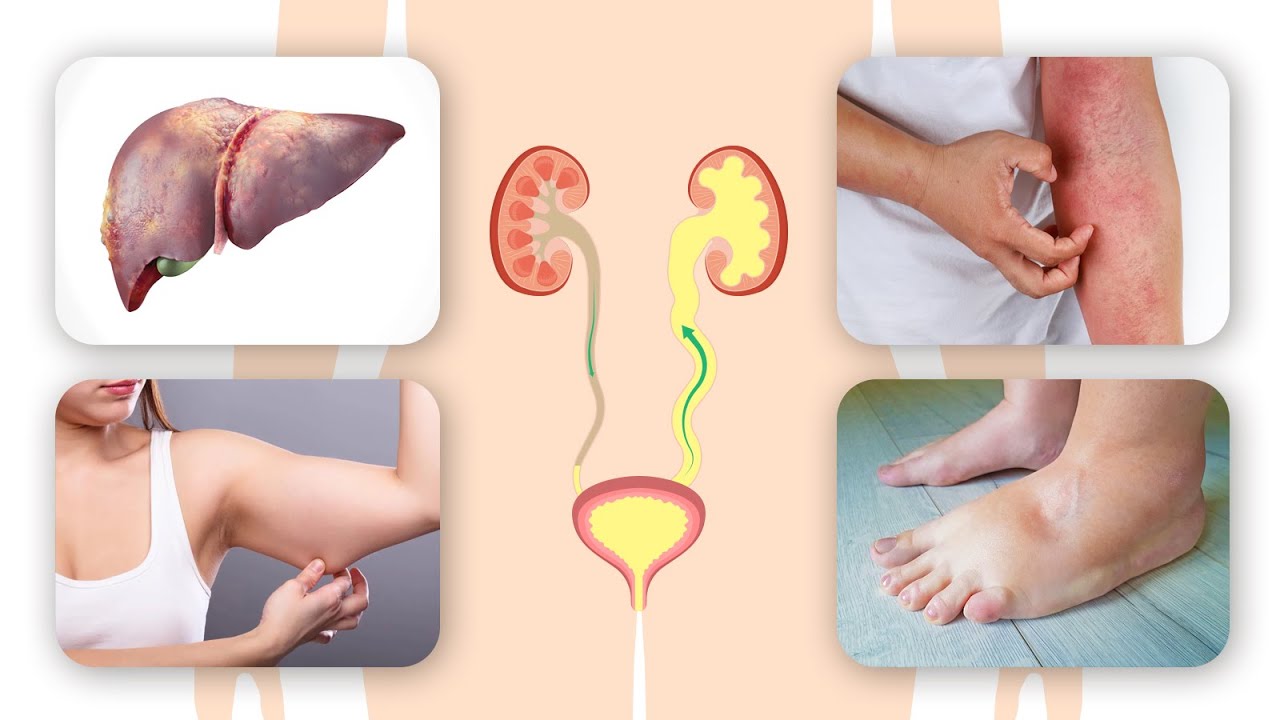 6 Benefits And Side Effects Of Flaxseed 7 Contrain