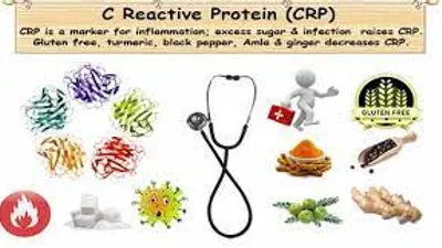 8 Effects And Side Effects Of Bromelain 5 Contrain